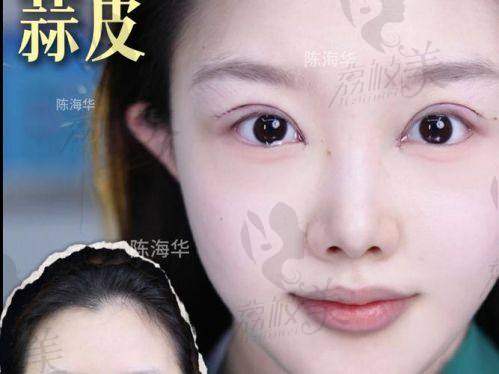 上海眼修復(fù)醫(yī)生杜園園醫(yī)生預(yù)約難嗎？真實(shí)反饋與預(yù)約攻略帶你一探究竟！