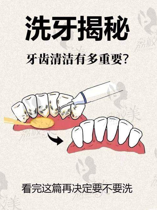 2025清木口腔醫(yī)院收費(fèi)高嗎多少錢(qián)？洗牙180+補(bǔ)牙188+根管治療626+牙齒矯正13000+