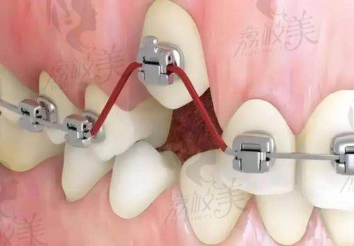 深圳穗华口腔门诊部预约挂号方式及流程