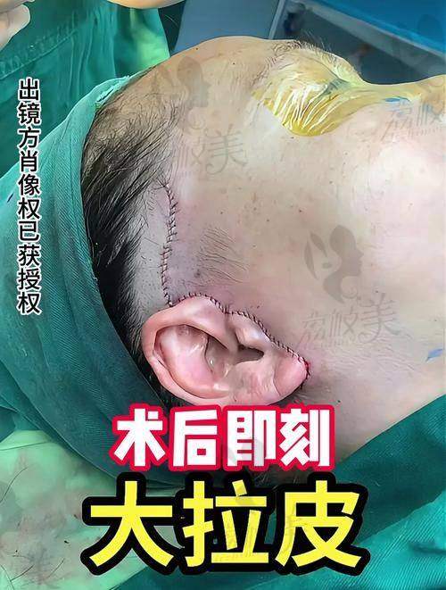 李曉東