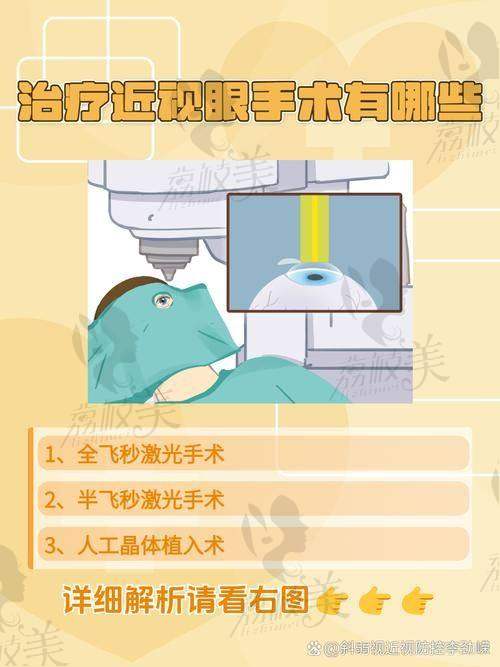 2. 鄭州尖峰劉保松全飛秒價(jià)格揭秘：全飛秒近視手術(shù)性價(jià)比之選