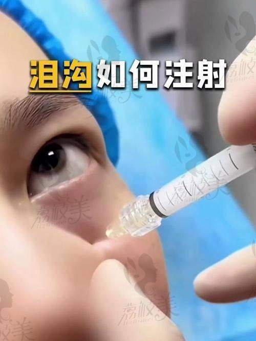 上海填充泪沟哪家医院好需要多少钱？这些医院和价格你不能错过！