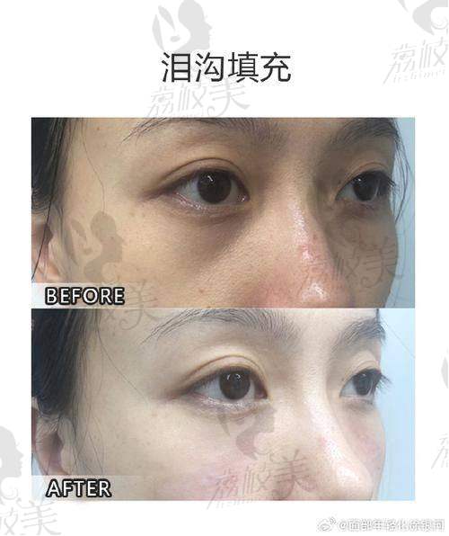 上海诺曼姿医疗美容诊所：小而精、术后管理比较用心