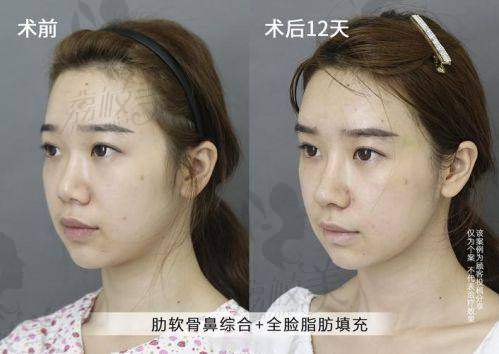中山贝熙王牌医生：美鼻魔法师