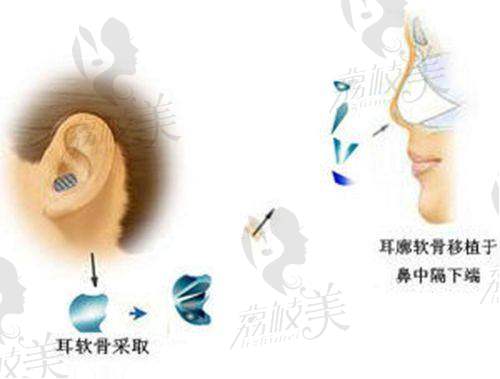 中山贝熙：实力医院，美鼻保护