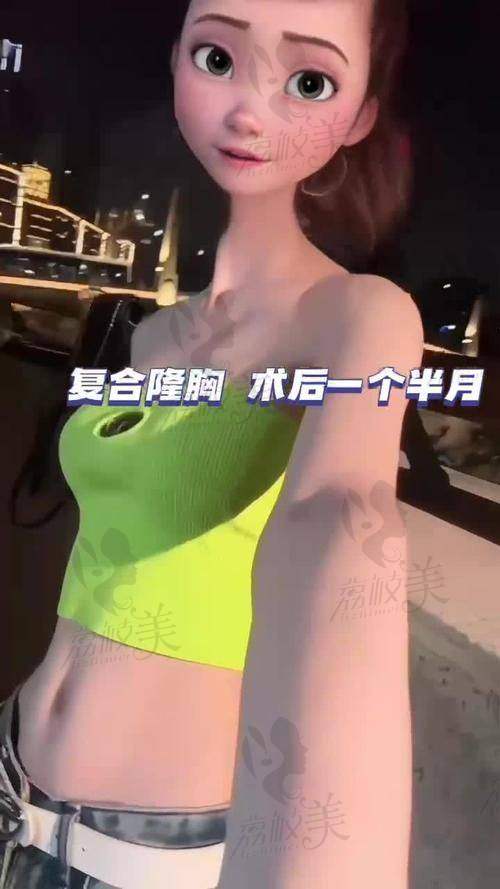 李朕自体脂肪隆胸丰胸价格45800元，胸型自然柔软真香曲线诱人