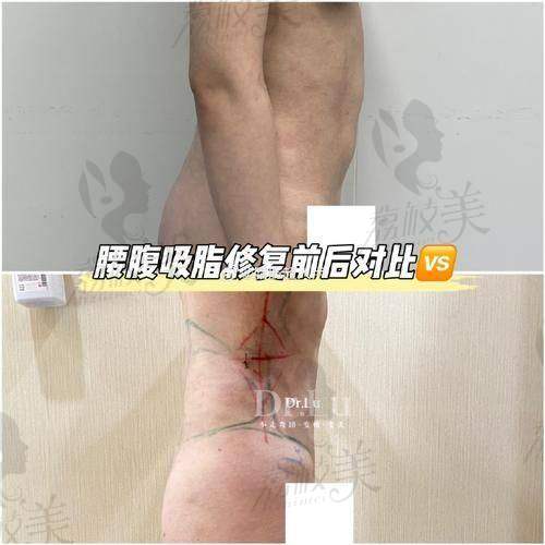 那么,“变瘦魔法石”到底值不值得信?