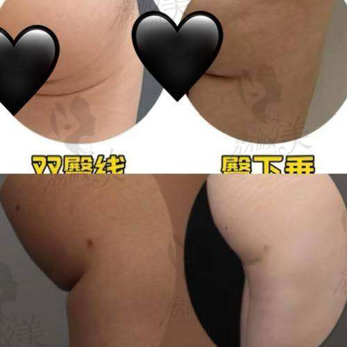 真实反馈:那些“悄悄变瘦的人”都说了什么?