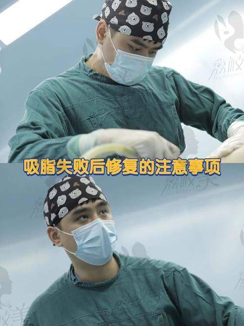 水动力吸脂技术亮点在哪?