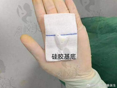 中山貝熙醫(yī)院實力大揭秘：硅膠鼻基底填充的堅強后盾！