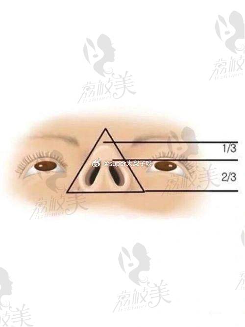 中山貝熙鼻尖取軟骨：真人實(shí)例見(jiàn)證奇跡