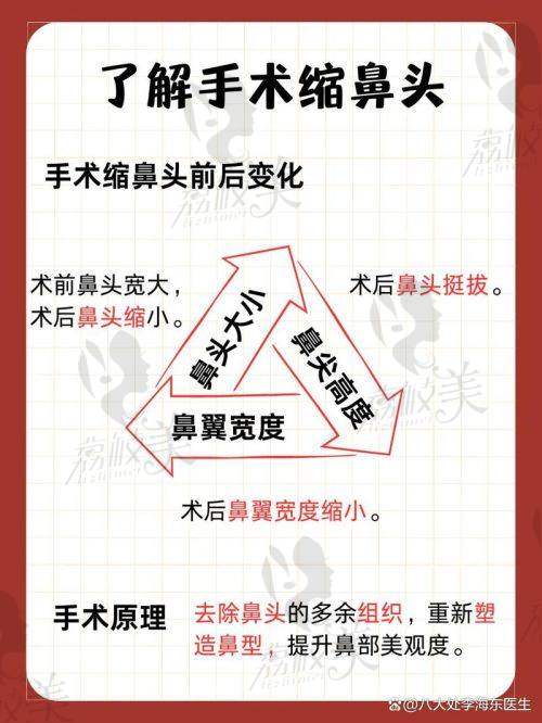 中山貝熙醫(yī)院：鼻尖取軟骨 16000 元起的價(jià)格絕殺