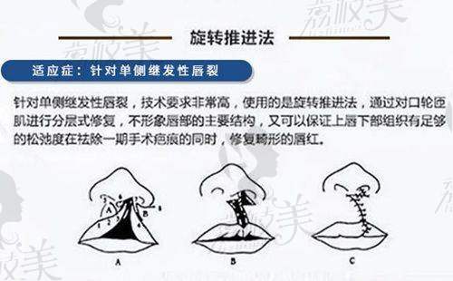 曾开达医生执业信息