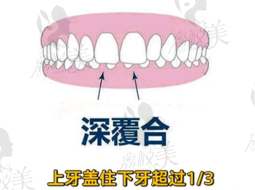 毕节京州口腔医院矫正牙齿收费8800起， 张伦文医生亲诊隐形美齿黑科技让笑容轻松上镜