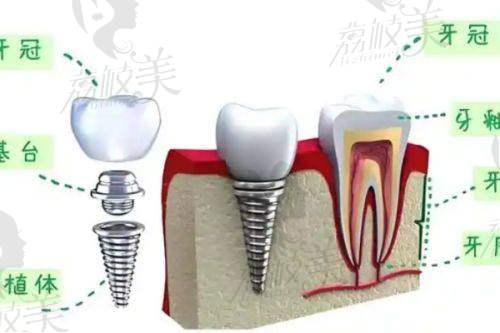 【深圳玖艺口腔诊所是私立还是公办】