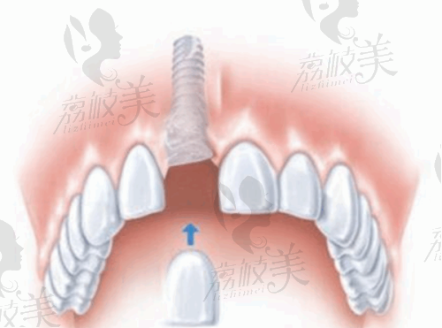 【北京东直门口腔第八门诊部地址及乘车路线】