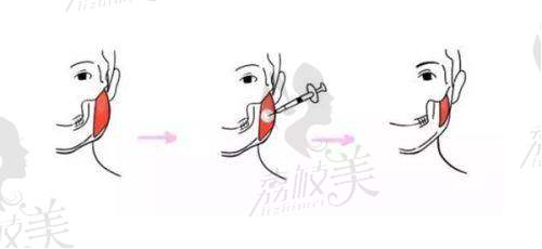 曾开达医生怎么预约挂号?