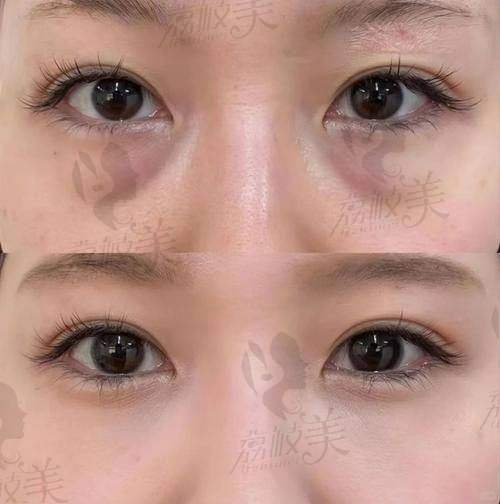 如何挂号北京闫立新医生？操作细节揭秘