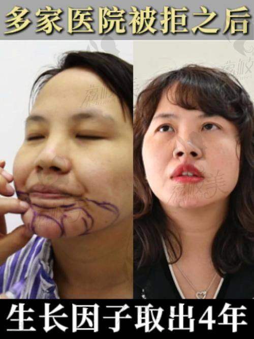 适合找丁小邦就诊的情况人群