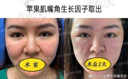 丁小邦特殊技术亮点：做到“稳、准、小、全”