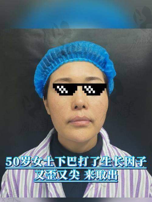 广州漫一凡医生取生长因子是正规的吗？是正规的