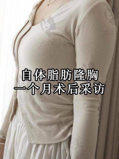 李春财自体脂肪填充丰胸有 26 年经历价格 15000，存活率高手感软 fufu 绝了
