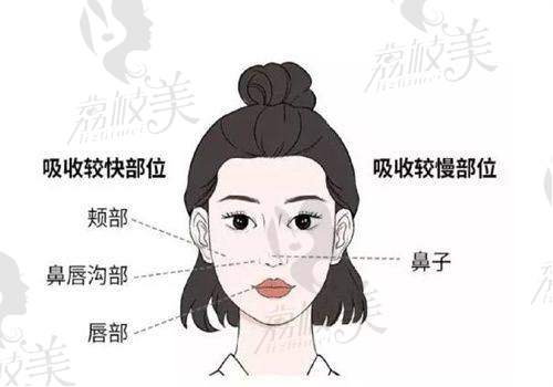 选择武汉艺星刘芳岑医生进行眼周口周年轻化治疗需要注意什么？