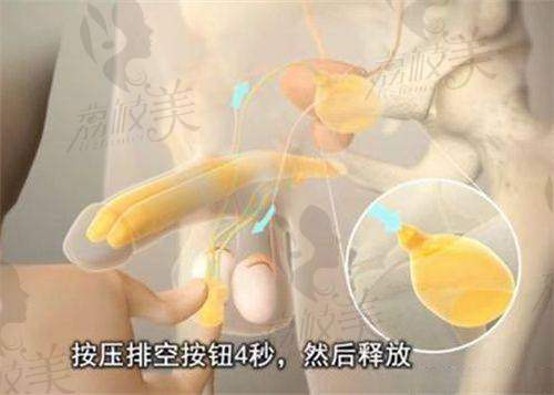 医生团队在唇裂继发鼻基底修复术的临床经验