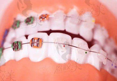 宝鸡牙博仕口腔医院刘宣庆医生靠谱吗？毕业于西安交大，擅长多领域口腔治疗