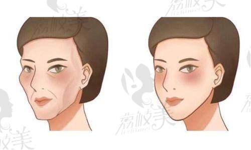 深圳花漾医疗美容诊所是正规的吗？