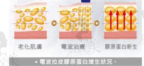 刘芳岑医生在眼周口周年轻化方面有什么独特之处？