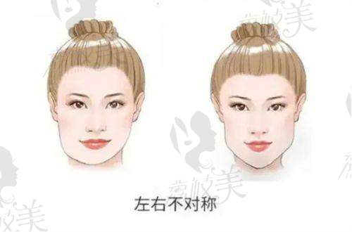 外阴饱满注射项目有哪些成效和好处？