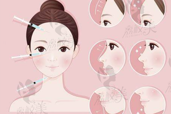 南阳艾美整形达芬奇美眼怎么样？技术革新、优势多，还质保10年超放心！
