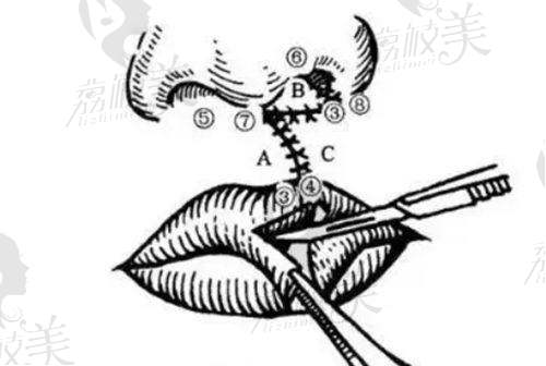张全武医生口碑怎么样？
