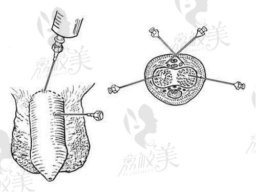 淮安童颜焕美医疗美容门诊部口碑怎么样?