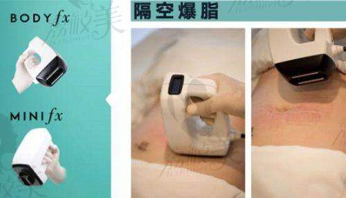 刘康医生擅长项目: