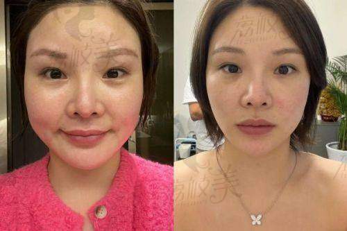 淮安童颜焕美医疗美容门诊部怎么预约挂号?