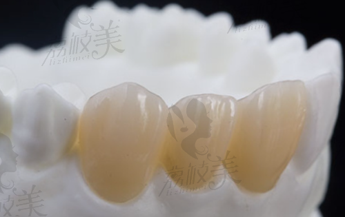 全口活动义齿的适用人群