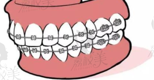 患者实例分享