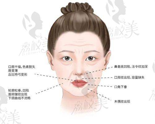 开内眼角项目：价格优势与特色