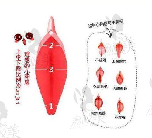 成都八大处整形医院私密整形好不好？求美者口碑还是很高的主要是医生技术好