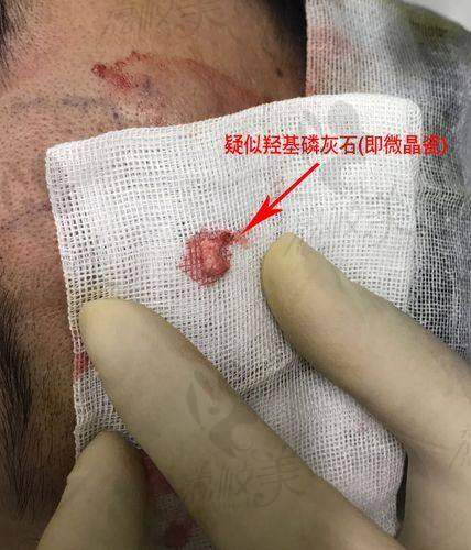 北京润美玉之光孙劲劲：实力医生的魅力所在