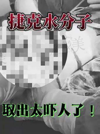 北京润美玉之光孙劲劲：胶原馒化修复价格太香啦！