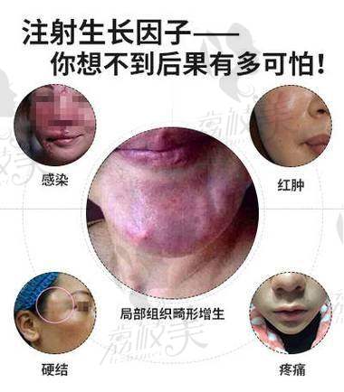 八大处郭鑫取生长因子靠谱收费19800起，安全取出还原原生美超放心