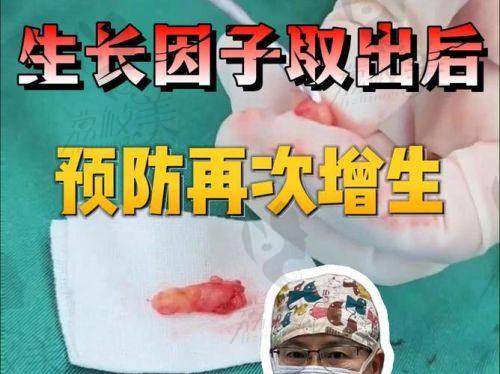 北京煤医周云超助力取下巴生长因子，仅需28000元起焕新美丽！ 