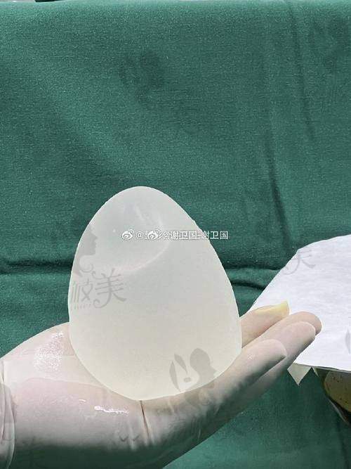 铂蕴假体隆胸的价格为何20万元起,具体受哪些因素影响?