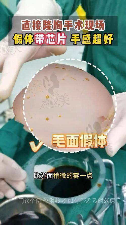 选择武汉五洲葛海辉铂蕴假体隆胸是否值得?