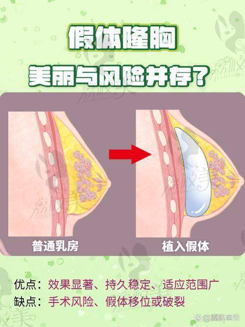 铂蕴假体隆胸与其他隆胸方式相比有何不同?