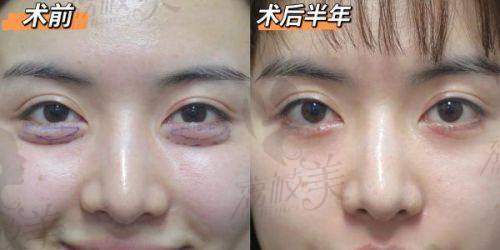 济南激光脱毛哪家医院做的好？盘点济南能做激光脱毛的医院