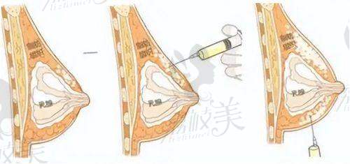 杨存昌技术优势